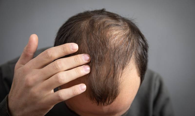 Mơ thấy vuốt tóc và tóc rụng